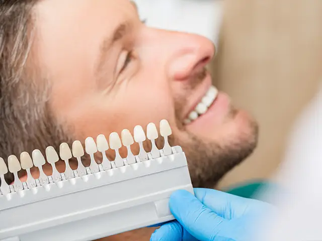 Dental Veneers - OGN Dental Studio Antalya, Turkey