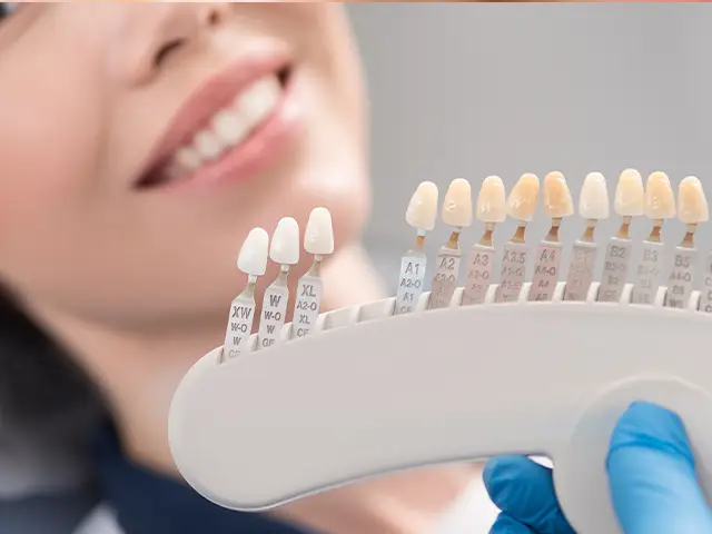 Zirconium Veneers - OGN Dental Studio Antalya
