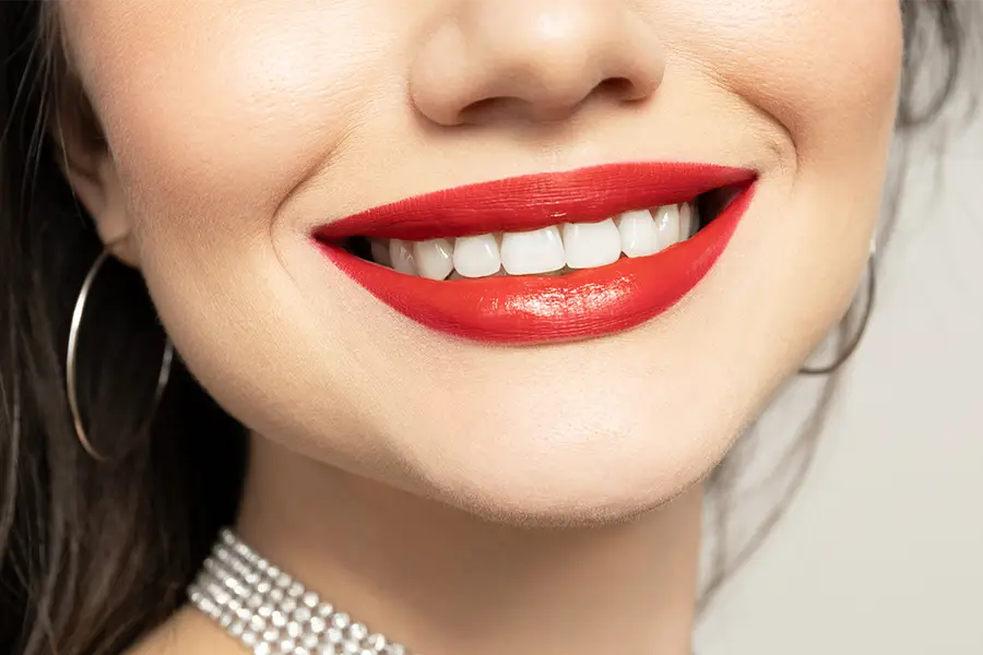 Hollywood Smile - Smile Design