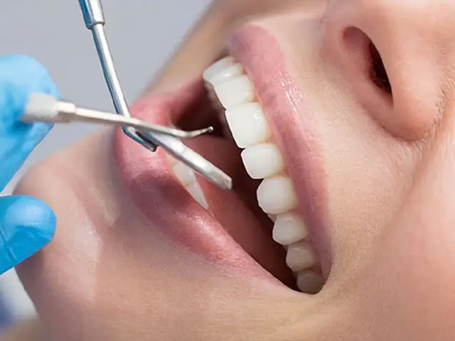 Root Canal Treatment