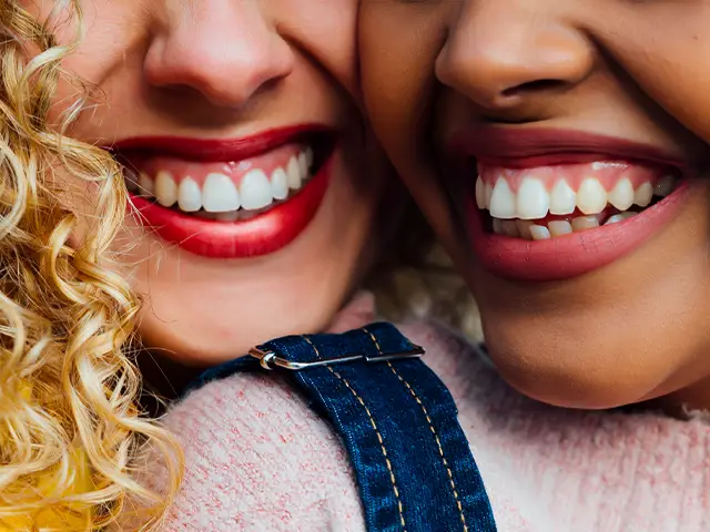 Professional Teeth Whitening