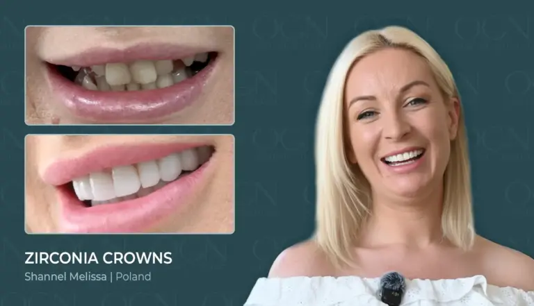 Before & After 9 Zirconia Crowns - Before & After