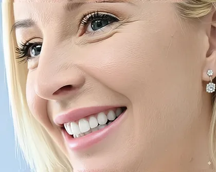 Hollywood Smile​