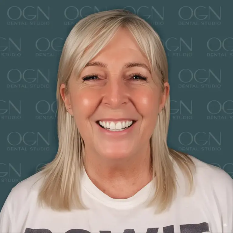 Галерея Улыбок - OGN Dental Studio