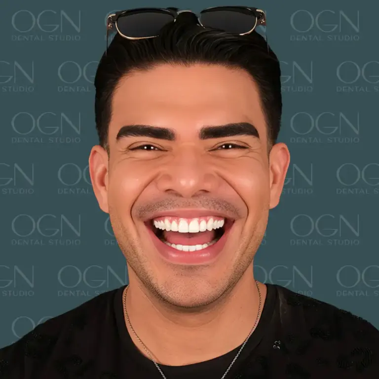 OGN Dental Studio - Smile Gallery
