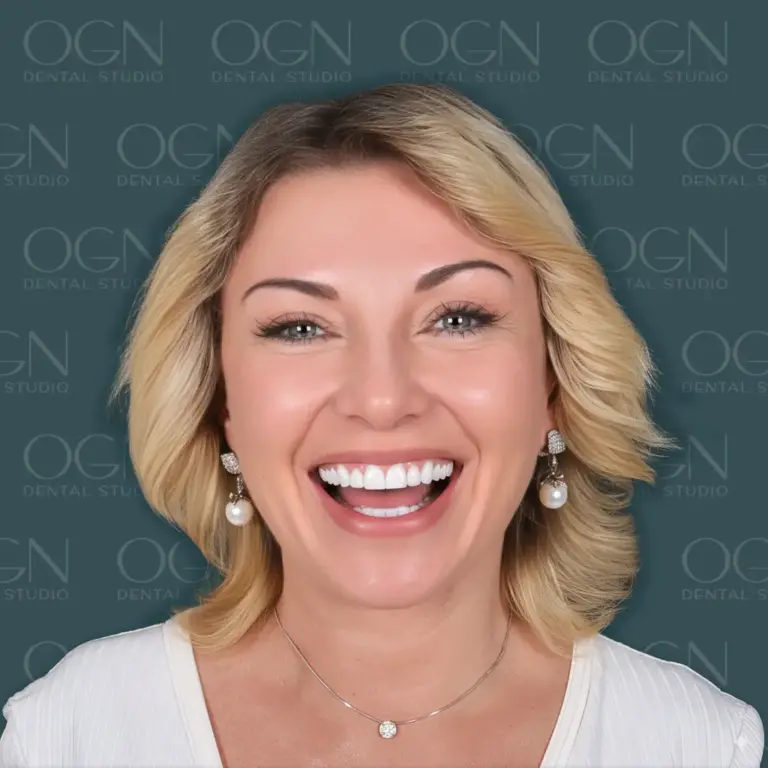 Lächelgalerie 15 Lächelgalerie - OGN Dental Studio