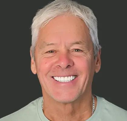 All on 4 Dental Implants