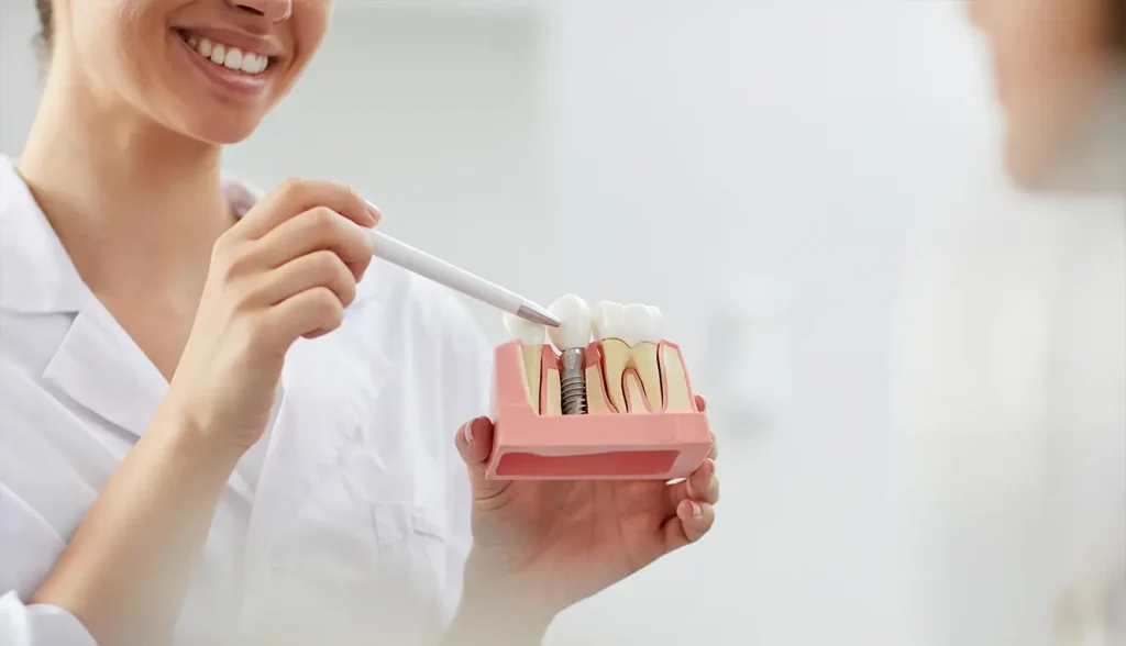 Implant Teeth Look Natural