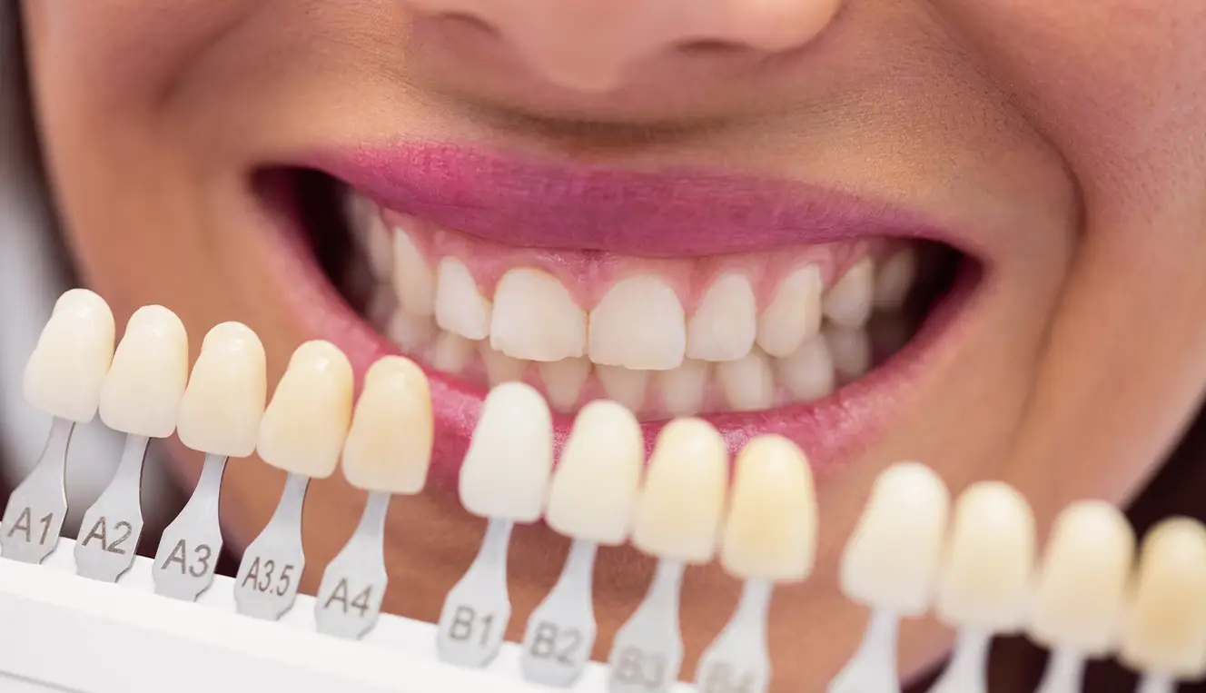 Home 43 Zirconium Crowns