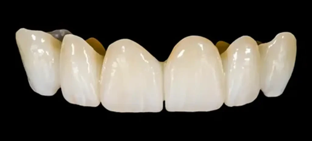 Zirconium Crowns