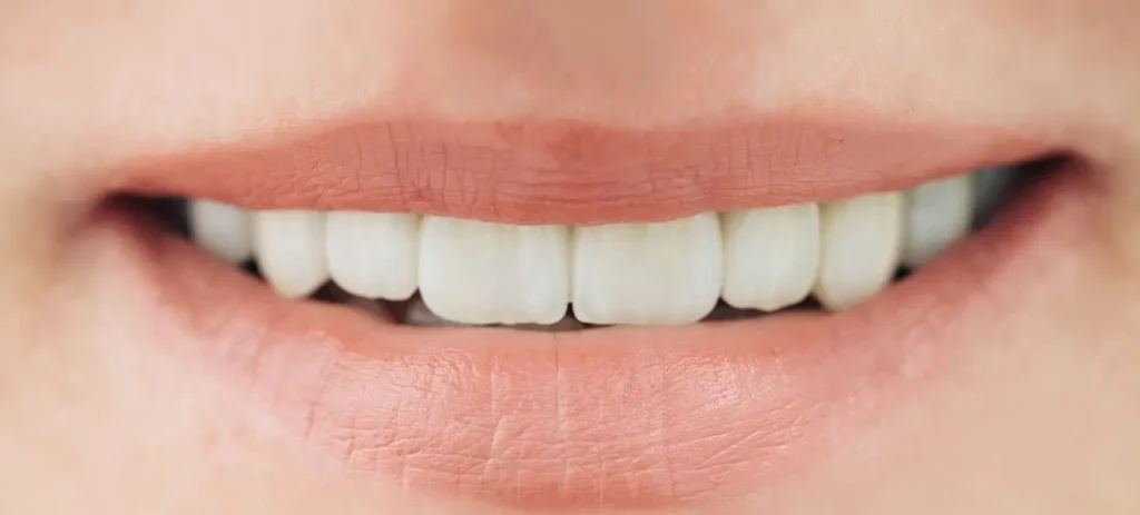 Zirconium Crowns