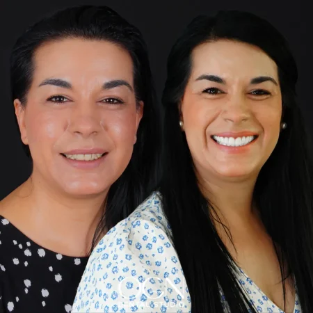 Before & After - OGN Dental - Antalya, Turkey
