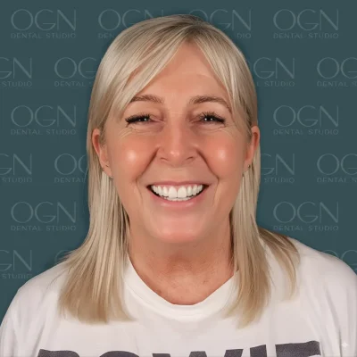 OGN Dental Studio - Smile Gallery