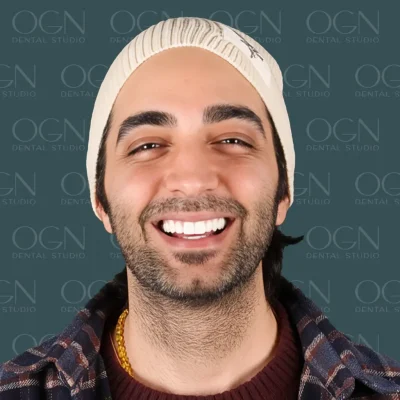 OGN Dental Studio - Smile Gallery
