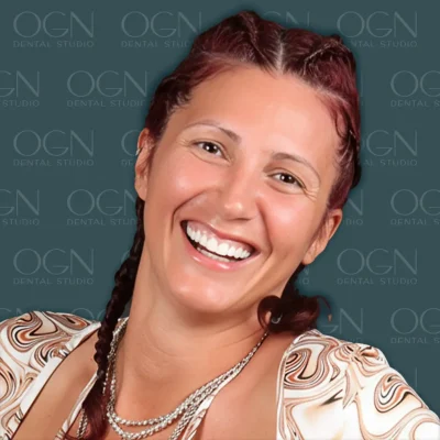 OGN Dental Studio - Smile Gallery