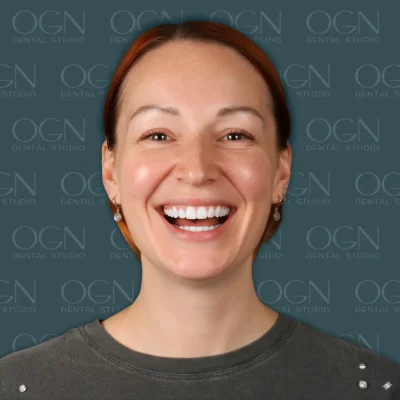 OGN Dental Studio - Smile Gallery