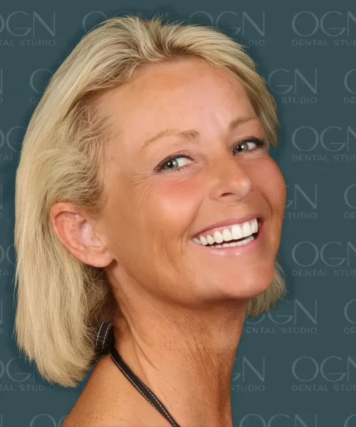 OGN Dental Studio - Lächelgalerie