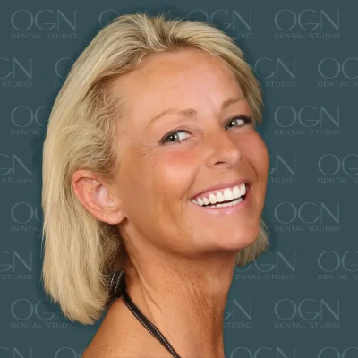 OGN Dental Studio - Smile Gallery